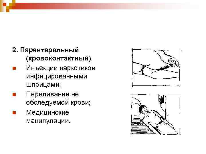 2. Парентеральный (кровоконтактный) n Инъекции наркотиков инфицированными шприцами; n Переливание не обследуемой крови; n