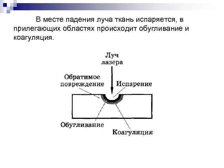 В месте падения луча ткань испаряется, в прилегающих областях происходит обугливание и коагуляция. 