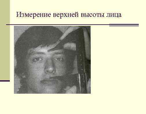 Измерение верхней высоты лица 