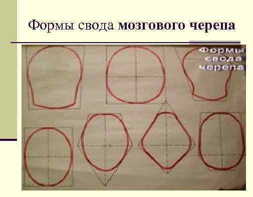 Формы свода мозгового черепа 