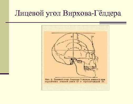 Лицевой угол Вирхова Гёлдера 