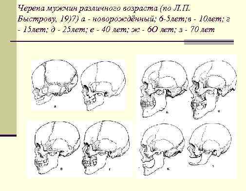 Черепа мужчин различного возраста (по Л. П. Быстрову, 19)7) а - новорождённый; 6 -5