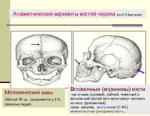 Атавистические варианты костей черепа (по А. П. Быстрову) Метопические швы Лобный М. ш. сохраняется