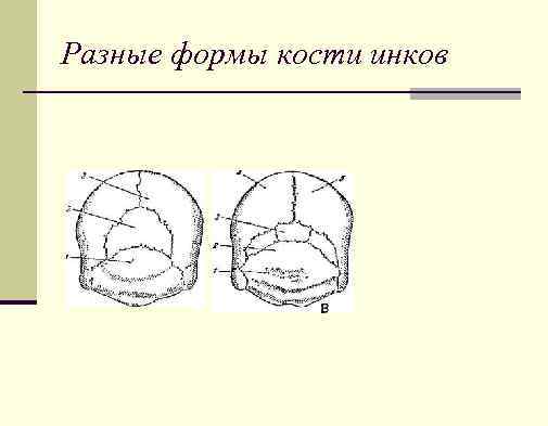 Разные формы кости инков 