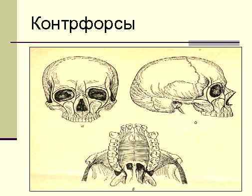 Контрфорсы 