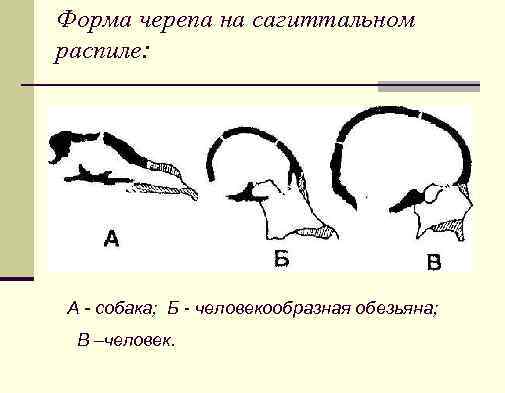 Форма черепа на сагиттальном распиле: А - собака; Б - человекообразная обезьяна; В –человек.