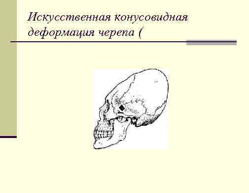 Искусственная конусовидная деформация черепа ( 