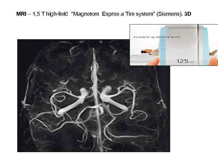 MRI – 1, 5 T high-field “Magnetom Espree a Tim system” (Siemens). 3 D
