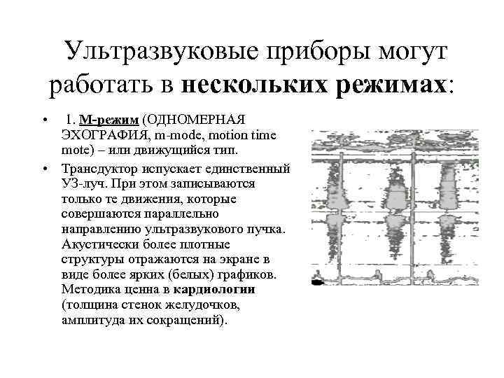 Ультразвуковые приборы могут работать в нескольких режимах: • 1. М-режим (ОДНОМЕРНАЯ ЭХОГРАФИЯ, m-mode, motion