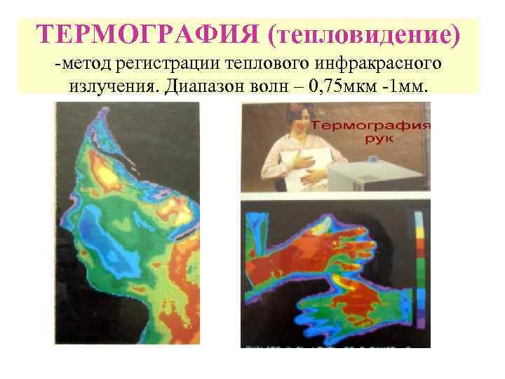 ТЕРМОГРАФИЯ (тепловидение) -метод регистрации теплового инфракрасного излучения. Диапазон волн – 0, 75 мкм -1