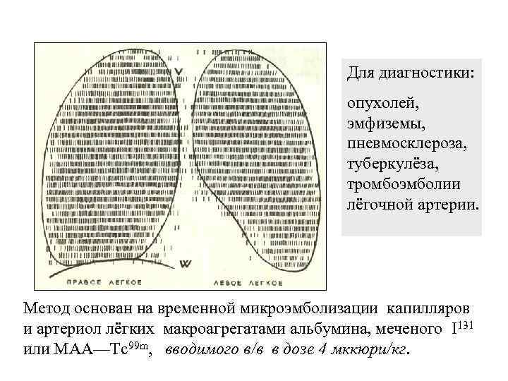 Для диагностики: опухолей, эмфиземы, пневмосклероза, туберкулёза, тромбоэмболии лёгочной артерии. Метод основан на временной микроэмболизации