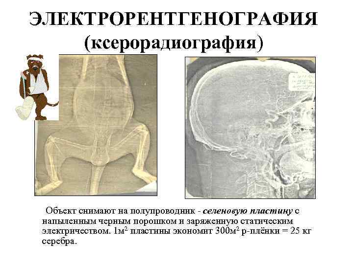 ЭЛЕКТРОРЕНТГЕНОГРАФИЯ (ксерорадиография) Объект снимают на полупроводник - селеновую пластину с напыленным черным порошком и