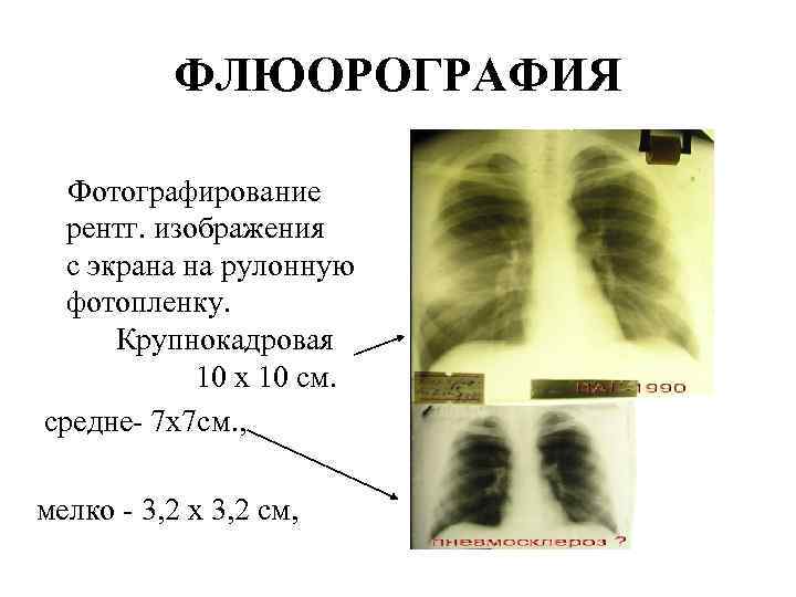 Телефон флюорографии