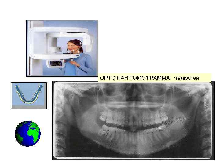 ОРТО ۥ ПАН ۥ ТОМО ۥ ГРАММА челюстей 