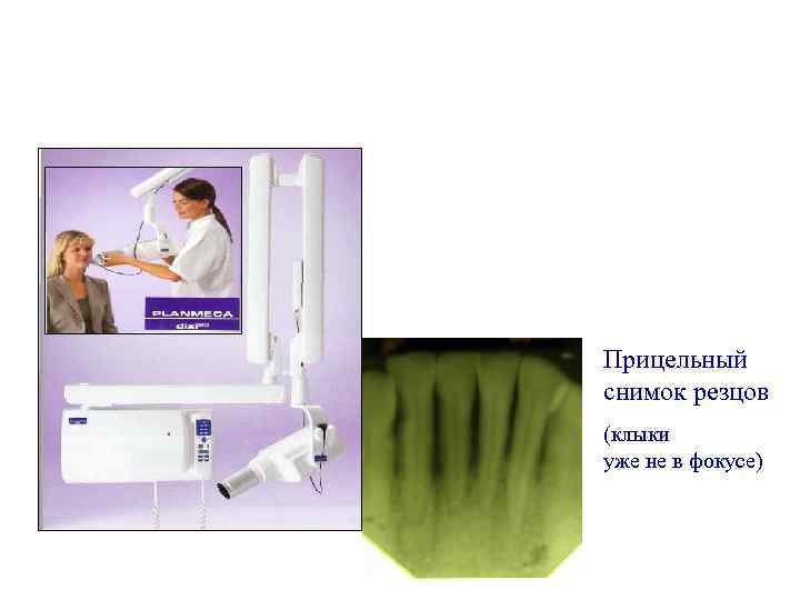 Прицельный снимок резцов (клыки уже не в фокусе) 