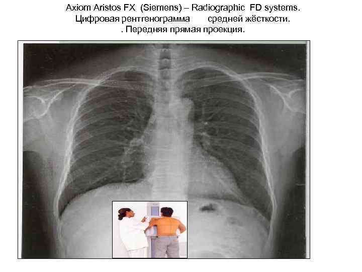 Axiom Aristos FX (Siemens) – Radiographic FD systems. Цифровая рентгенограмма средней жёсткости. . Передняя
