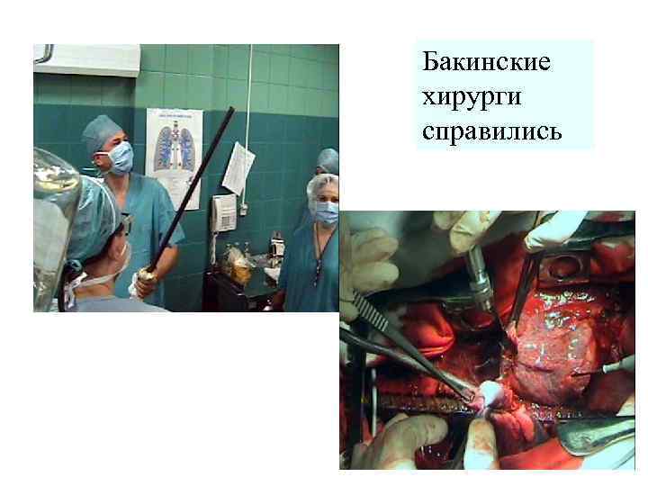 Бакинские хирурги справились 