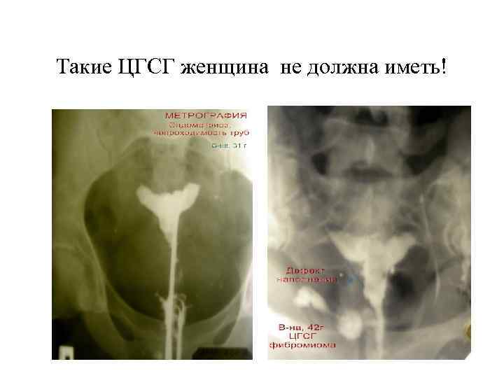Такие ЦГСГ женщина не должна иметь! 
