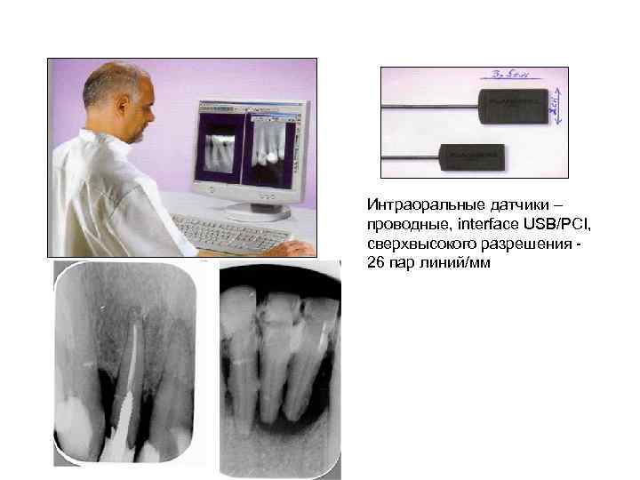 Интраоральные датчики – проводные, interface USB/PCI, сверхвысокого разрешения 26 пар линий/мм 