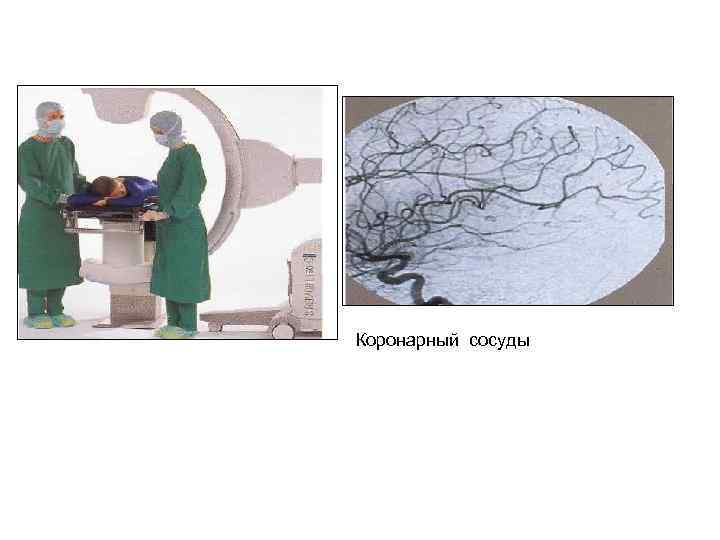 Коронарный сосуды 