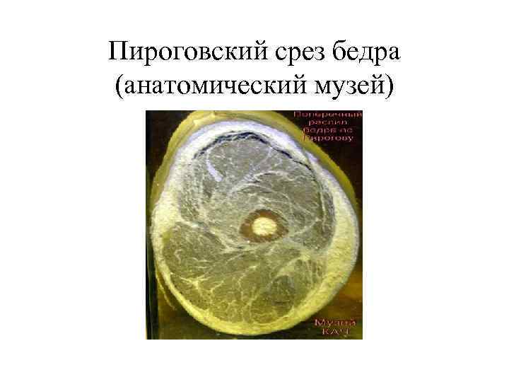 Пироговский срез бедра (анатомический музей) 