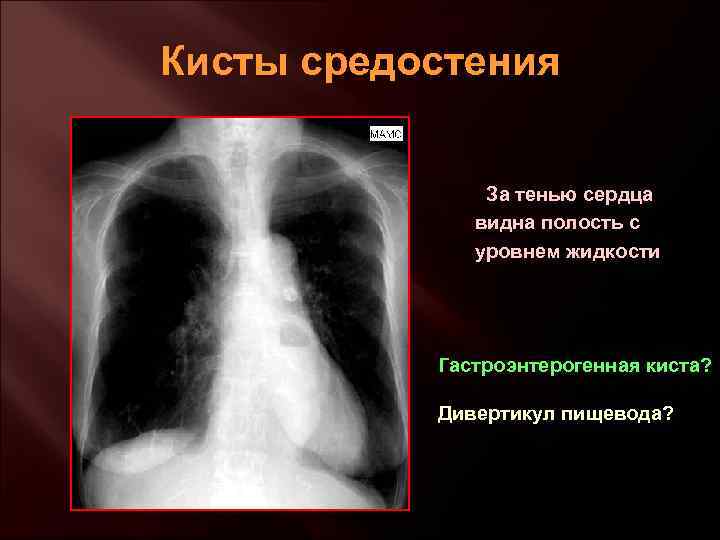 Стол при заболевании сердца