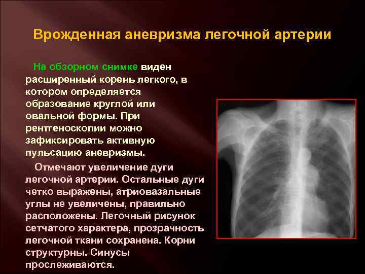 Презентация врожденные болезни