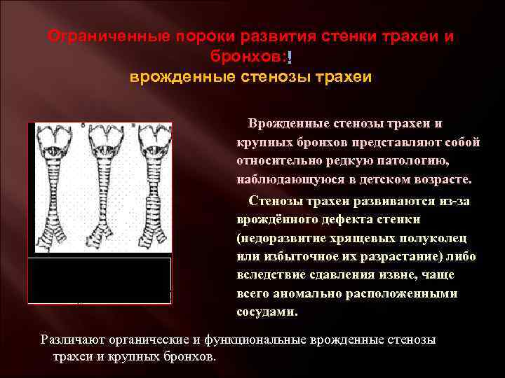 Ограниченные пороки развития стенки трахеи и бронхов: врожденные стенозы трахеи Врожденные стенозы трахеи и