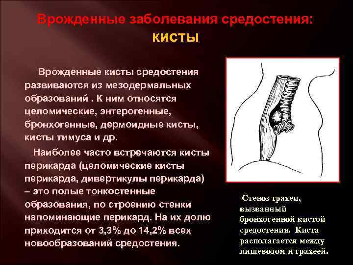 Врожденные заболевания средостения: кисты Врожденные кисты средостения развиваются из мезодермальных образований. К ним относятся