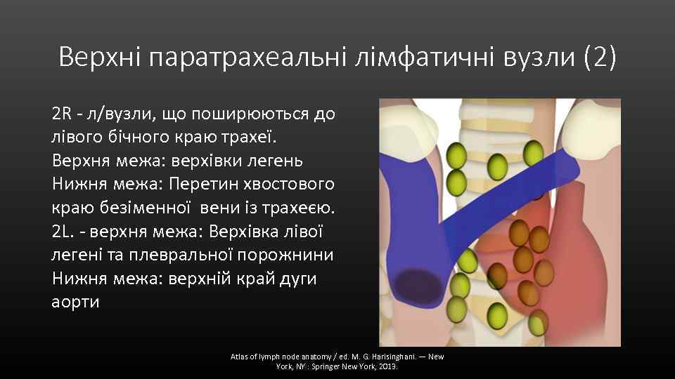 Верхні паратрахеальні лімфатичні вузли (2) 2 R - л/вузли, що поширюються до лівого бічного