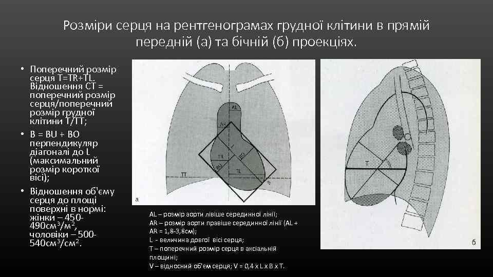 Розміри серця на рентгенограмах грудної клітини в прямій передній (а) та бічній (б) проекціях.