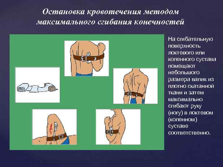 Кровотечение остановка кровотечения презентация