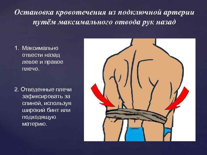 Остановка кровотечения из подключной артерии путём максимального отвода рук назад 1. Максимально отвести назад