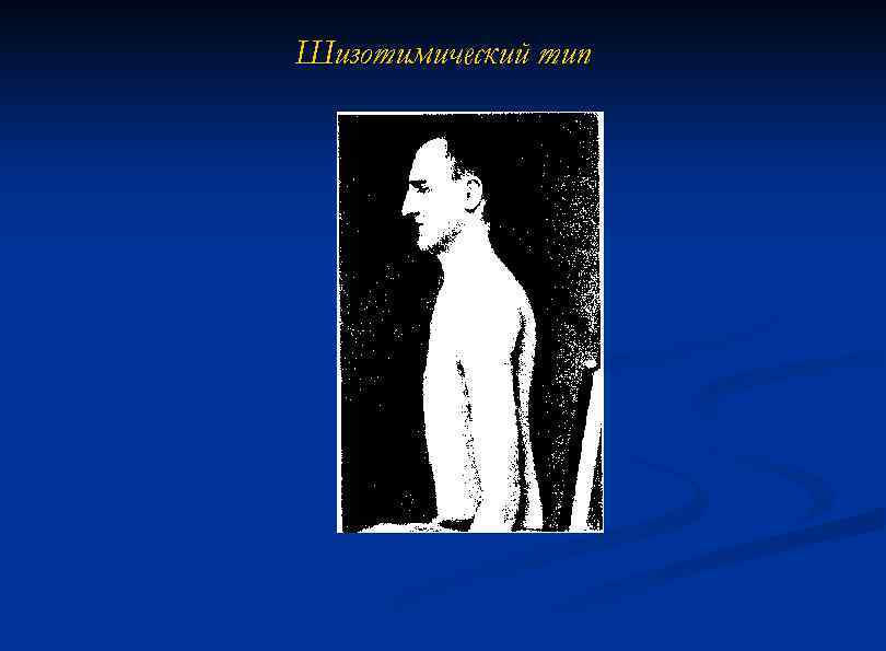 Шизотимический тип 