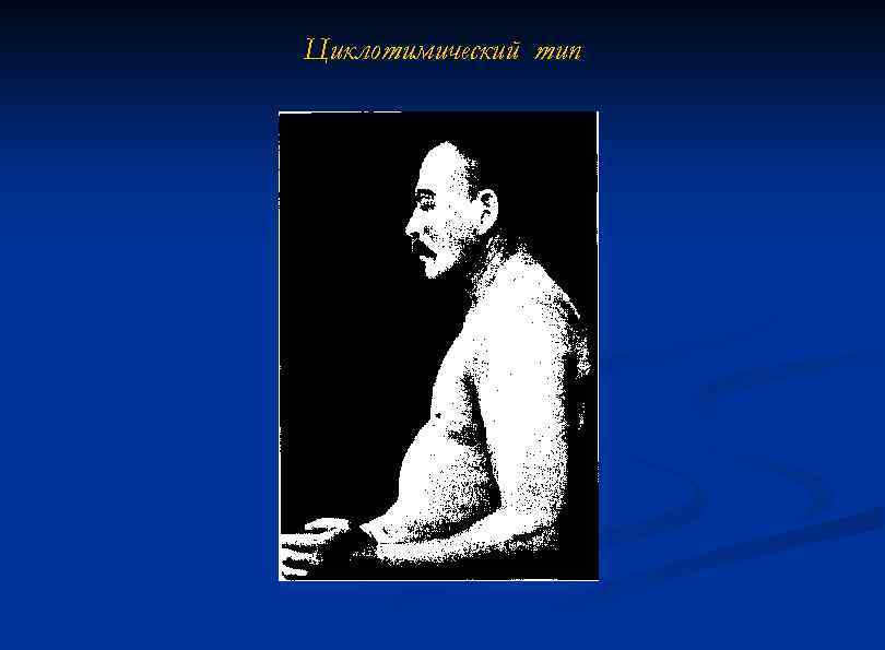 Циклотимический тип 