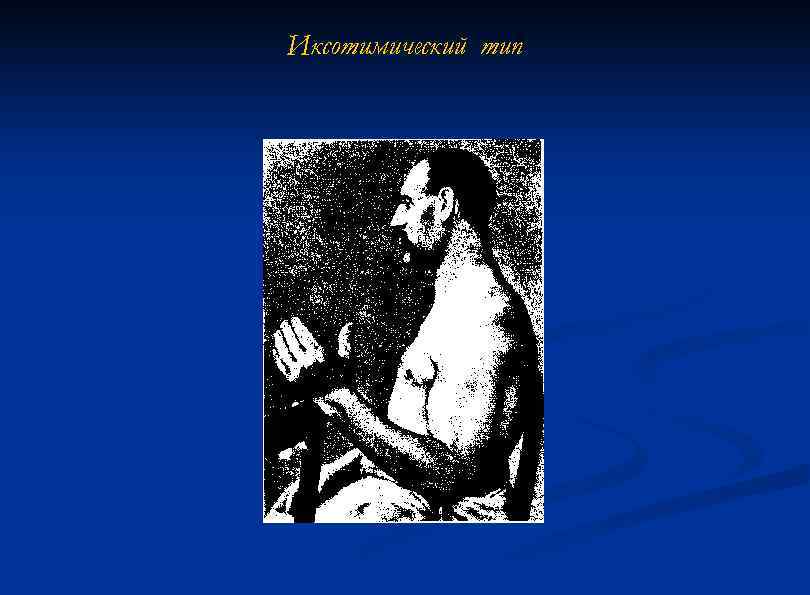 Иксотимический тип 