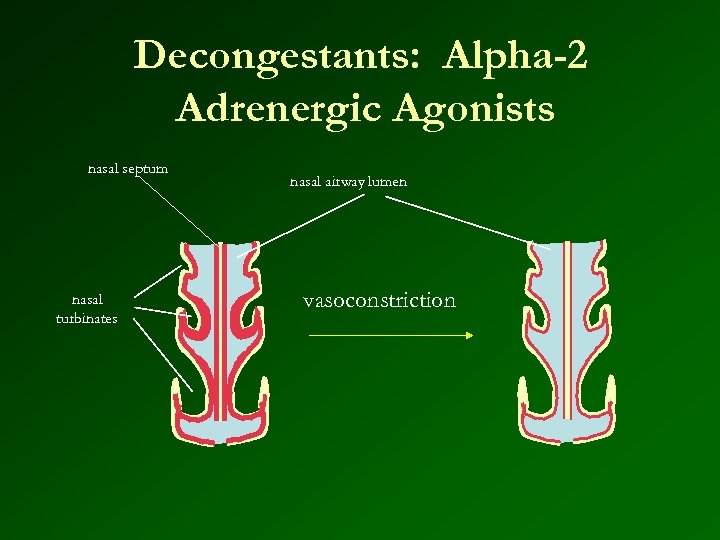 Decongestants: Alpha-2 Adrenergic Agonists nasal septum nasal turbinates nasal airway lumen vasoconstriction 