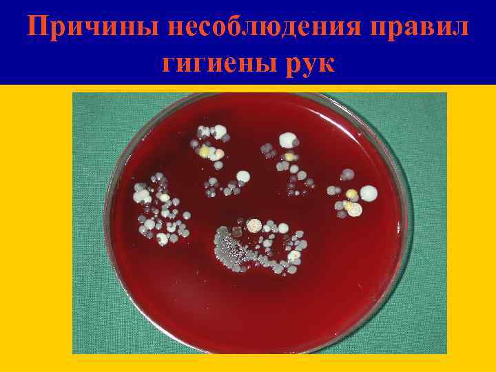 Причины несоблюдения правил гигиены рук 