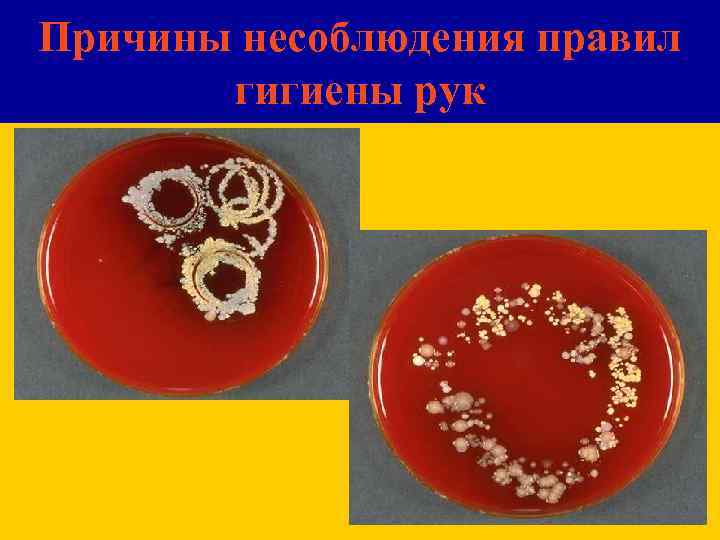 Причины несоблюдения правил гигиены рук 