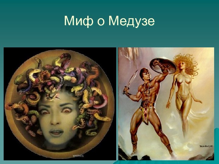 Миф о Медузе 