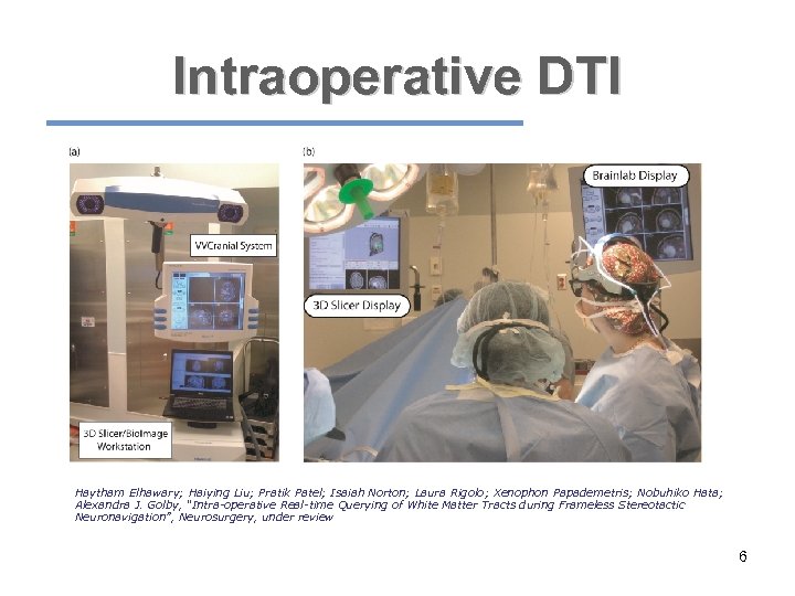 Intraoperative DTI Haytham Elhawary; Haiying Liu; Pratik Patel; Isaiah Norton; Laura Rigolo; Xenophon Papademetris;