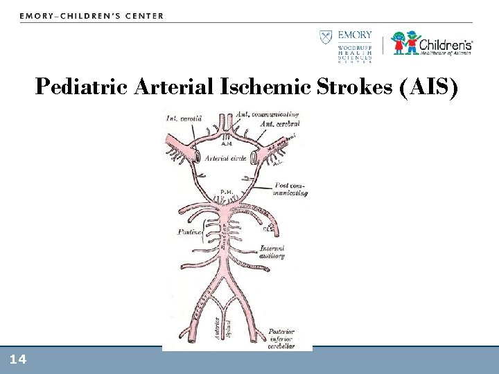 Pediatric Arterial Ischemic Strokes (AIS) 14 