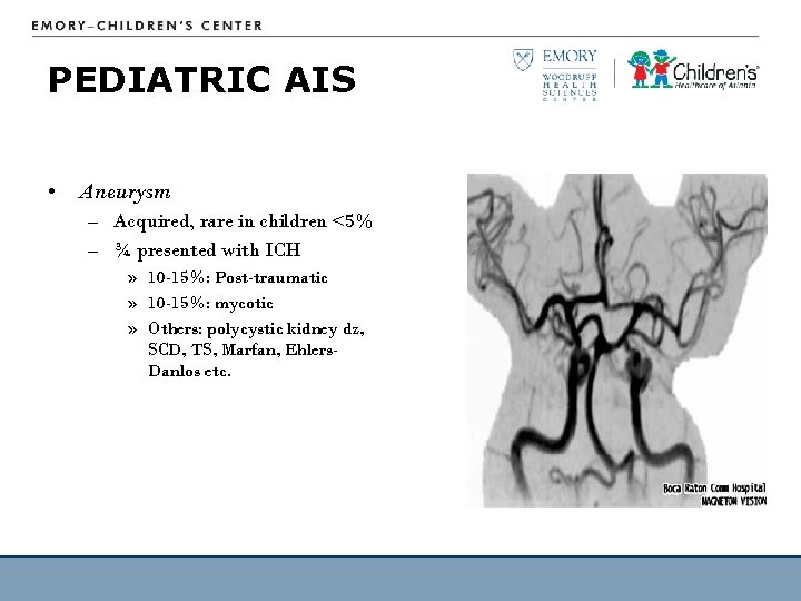 PEDIATRIC AIS • Aneurysm – Acquired, rare in children <5% – ¾ presented with