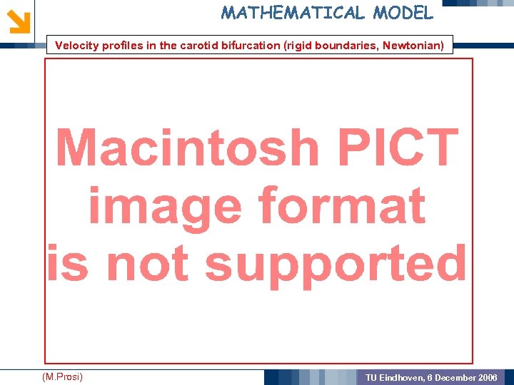 MATHEMATICAL MODEL Velocity profiles in the carotid bifurcation (rigid boundaries, Newtonian) GEOMETRIC PREPROCSSING MODEL
