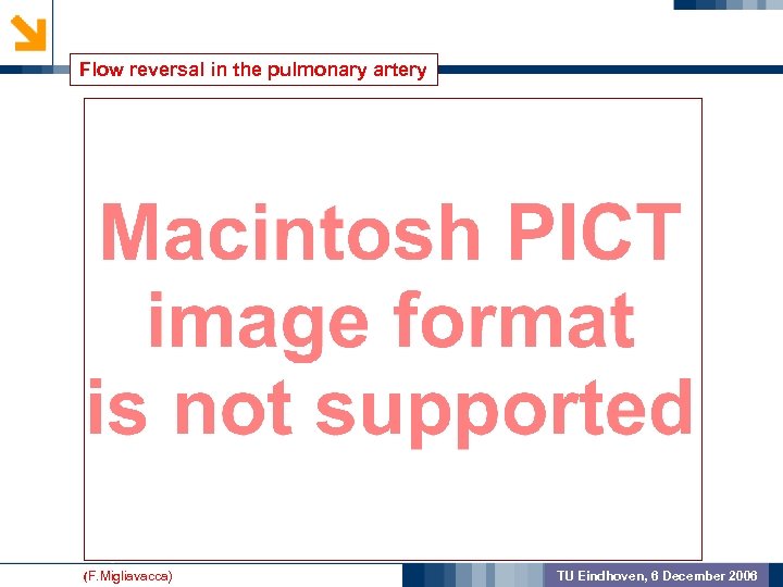 Flow reversal in the pulmonary artery GEOMETRIC PREPROCSSING MODEL VALIDATION OUTCOME (F. Migliavacca) TU