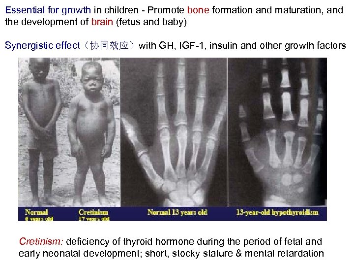 Essential for growth in children - Promote bone formation and maturation, and the development