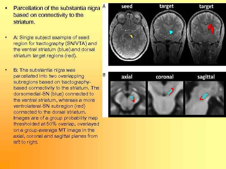  • Parcellation of the substantia nigra based on connectivity to the striatum. •
