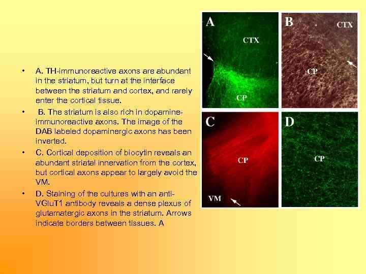 • • A. TH immunoreactive axons are abundant in the striatum, but turn