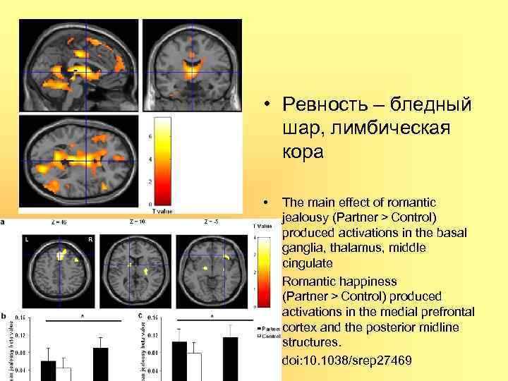  • Ревность – бледный шар, лимбическая кора • • • The main effect