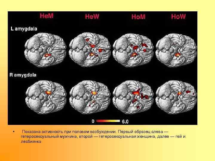  • Показана активность при половом возбуждении. Первый образец слева — гетеросексуальный мужчина, второй
